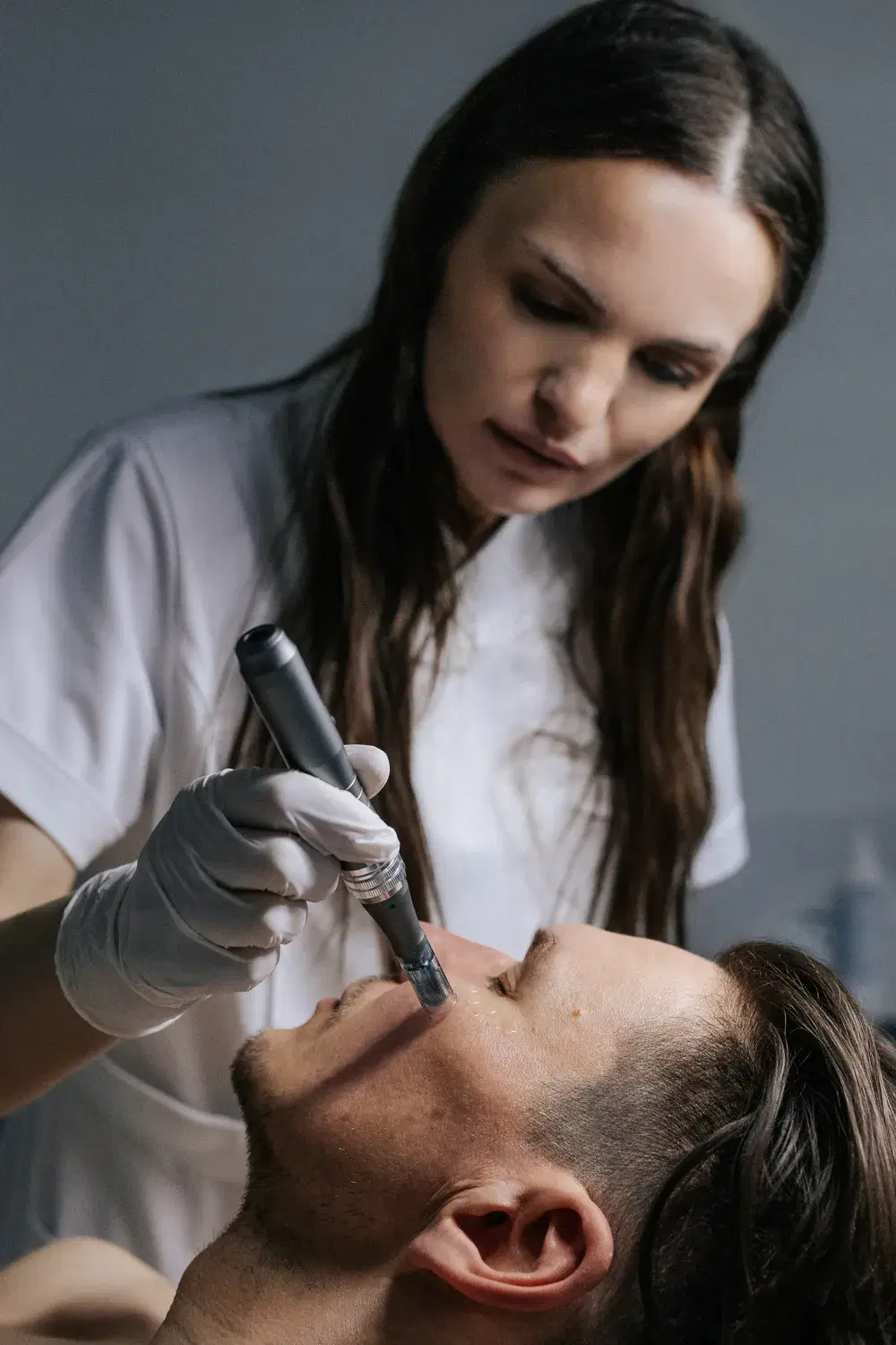 Microneedling treatment at Cells Aesthetics, Brighton & Hove